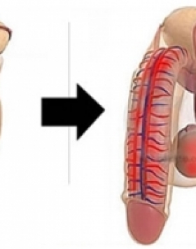 Como ter um aumento peniano Rapido ?